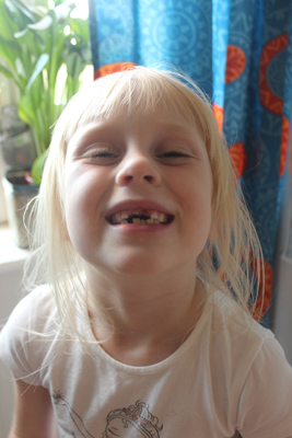 Med lite hjälp av Livias armbåge åkte Emelins tand äntligen ut! 